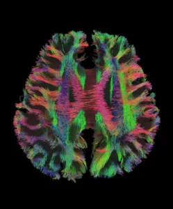 «Conmover al cerebro»: Neurociencia, creatividad y no-violencia en las aulas mendocinas